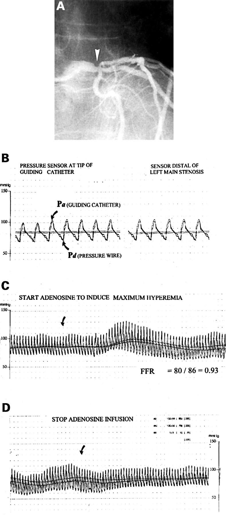 Figure 1  