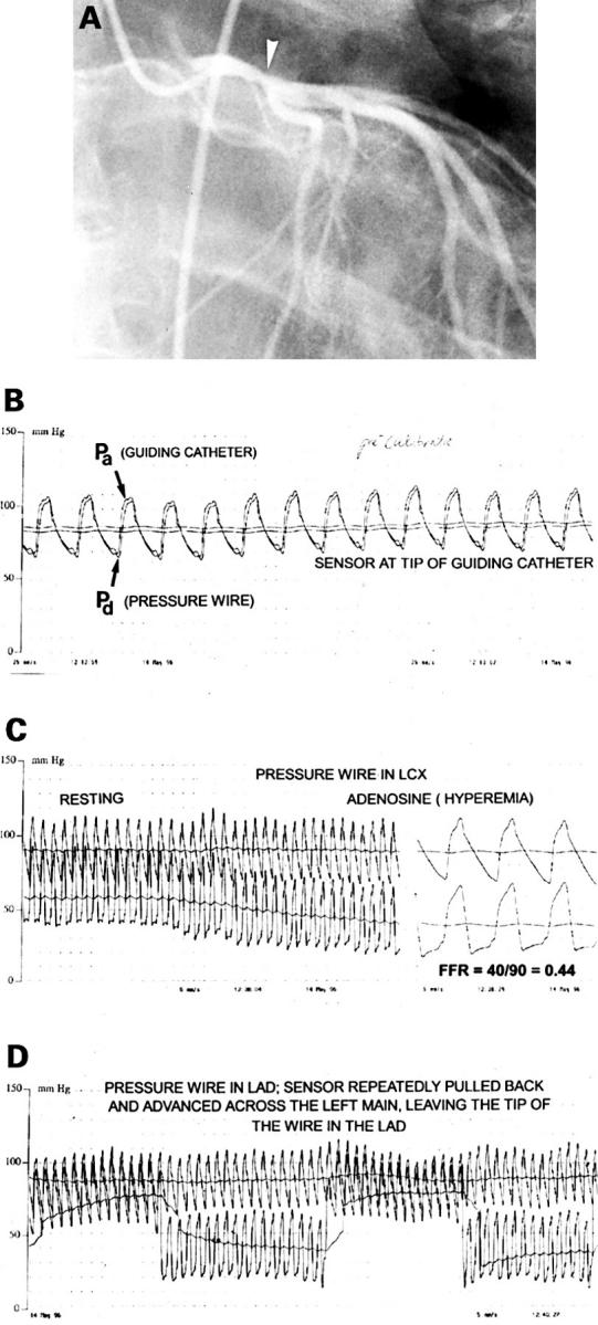 Figure 2  