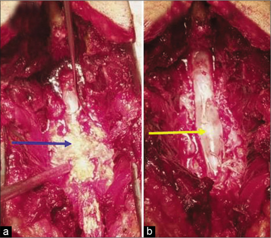 Figure 2: