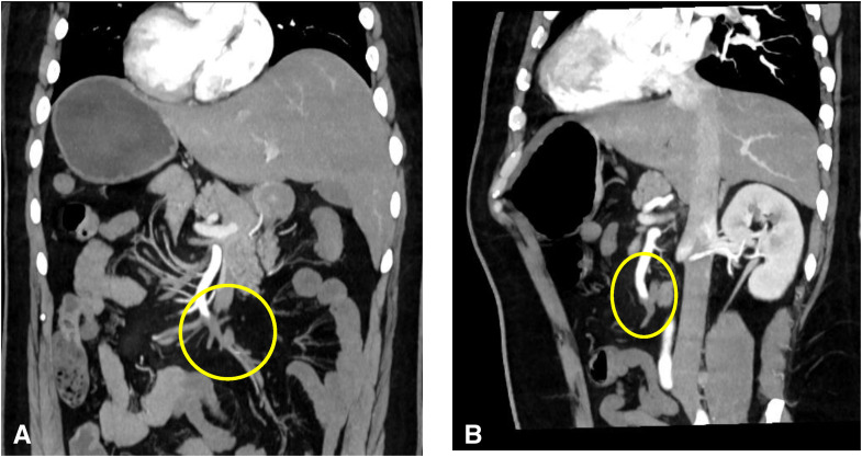 Figure 1