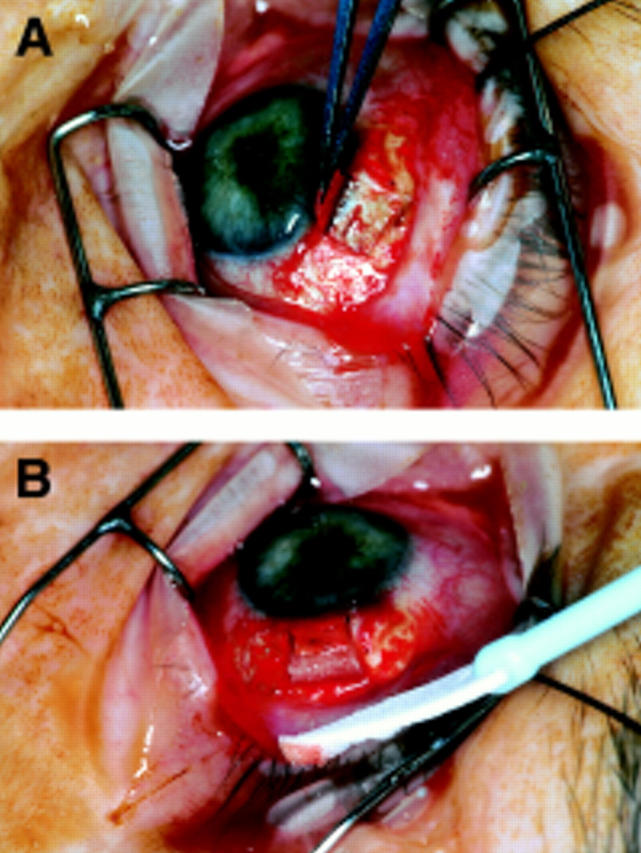 Figure 1  