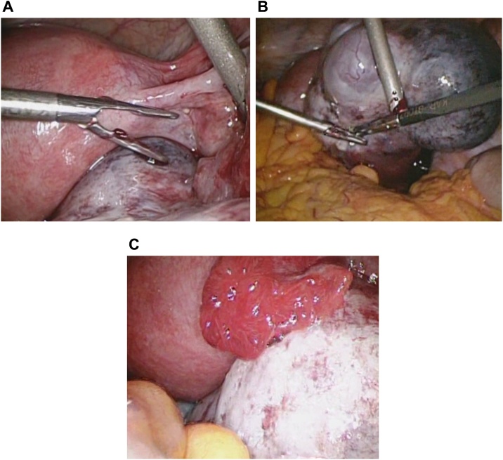 Fig. 3