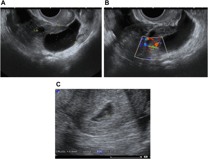 Fig. 1