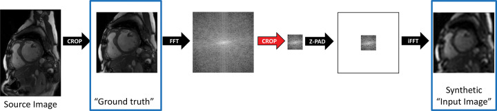 Diagram shows strategy for generation of synthetic training data. Source image data were first cropped to standardize image presentation to the neural network and were windowed in Fourier space to mimic a fully sampled low-resolution acquisition. The cropped images were later used as ground truth for training, and the downsampled images were used as synthetic input images. Z-PAD = zero padding.