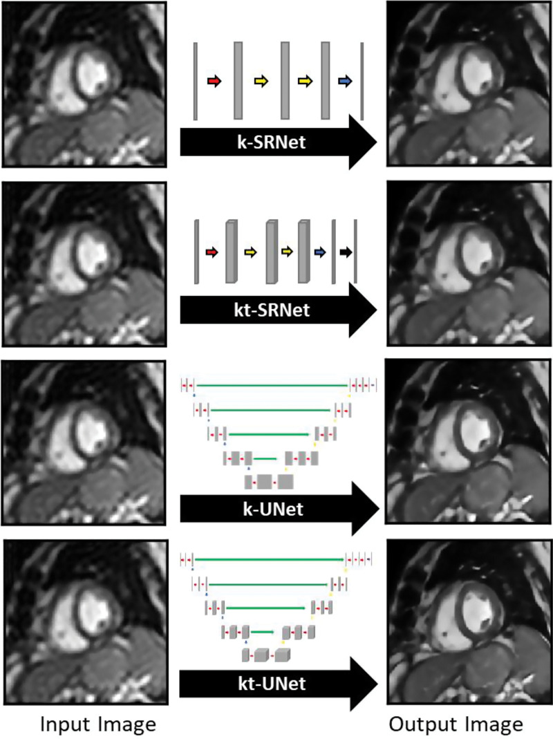 Images show prototype convolutional neural networks (CNNs) evaluated for their performance in generating single-frame (k) and multiframe (kt) super-resolution images. The k-SRNet and kt-SRNet CNNs are examples of shallow networks and k-UNet and kt-UNet are relatively deep CNNs used to perform this task.