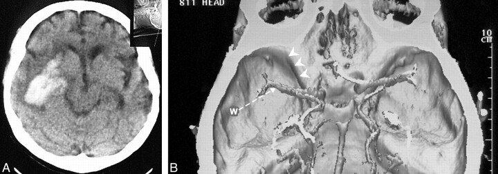 fig 2.