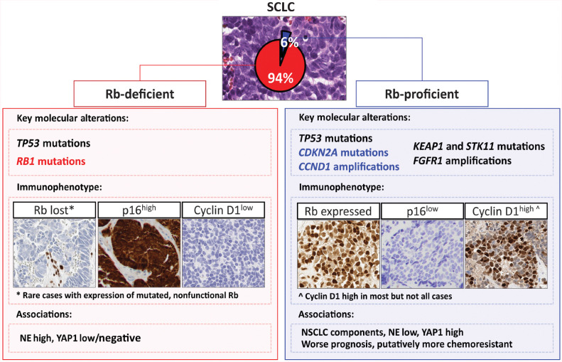 Figure 6. Diagram summarizing the distinct clinicopathologic and genomic characteristics of Rb-proficient SCLC. Enrichment in NSCLC histologic component and NSCLC-type genomic alterations in Rb-proficient SCLC suggests putative origin of these tumors from an overlapping precursor of NSCLC, with greater potential for divergent differentiation.