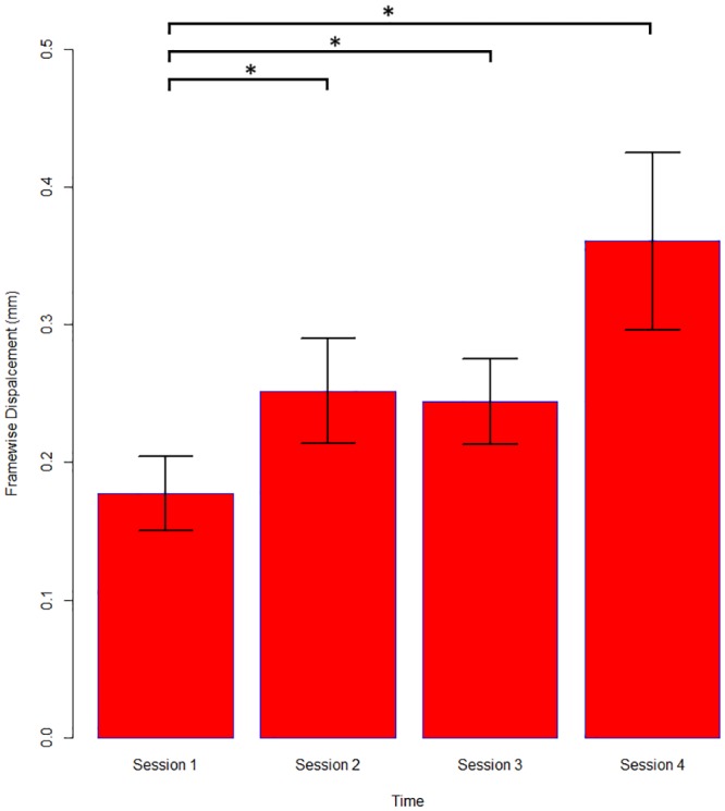 Optimising Eeg-fmri For Localisation Of Focal Epilepsy In Children - Pmc