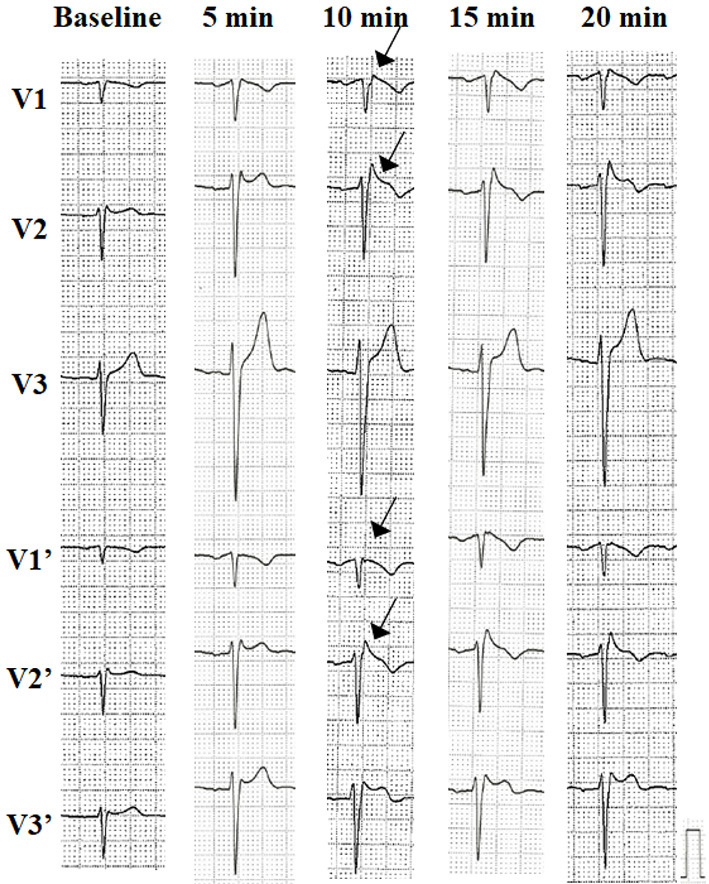 Figure 2.