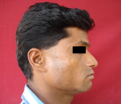 Fig. 2