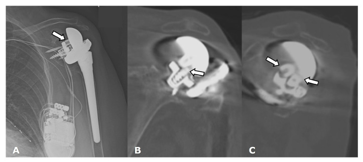 Figure 27