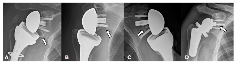 Figure 29