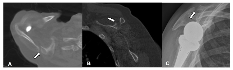 Figure 19