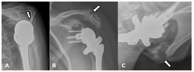 Figure 18