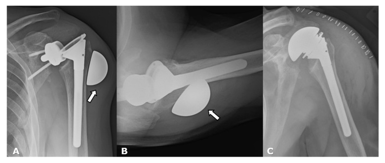 Figure 26