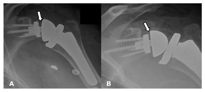 Figure 28