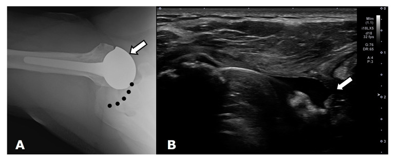 Figure 21