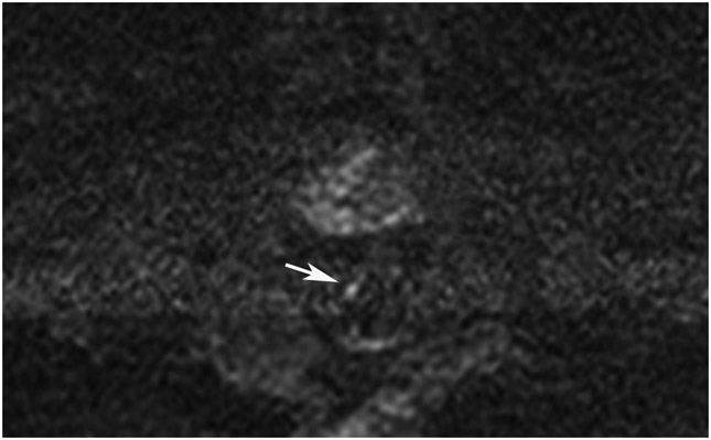 Figure 21: