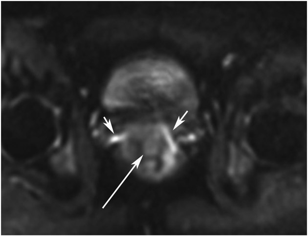 Figure 22: