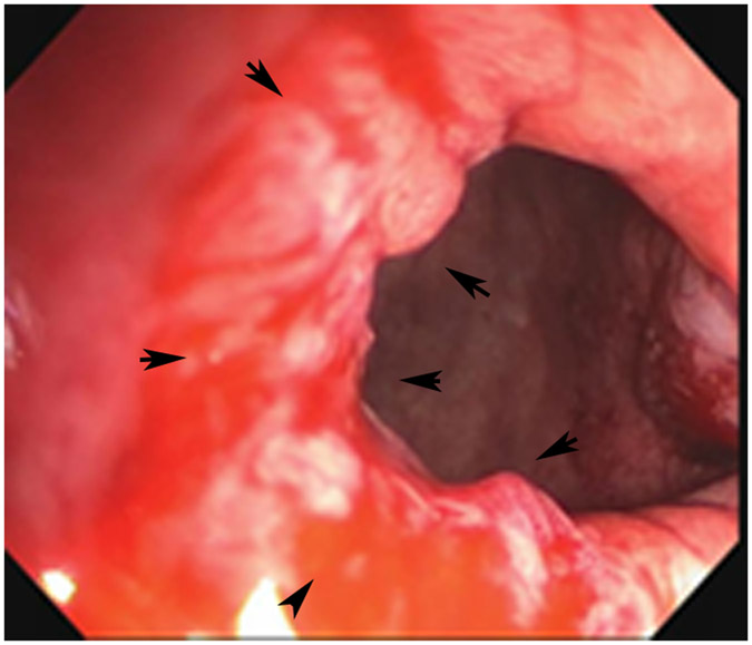 Figure 22: