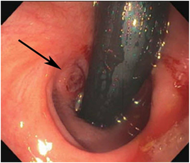 Figure 21: