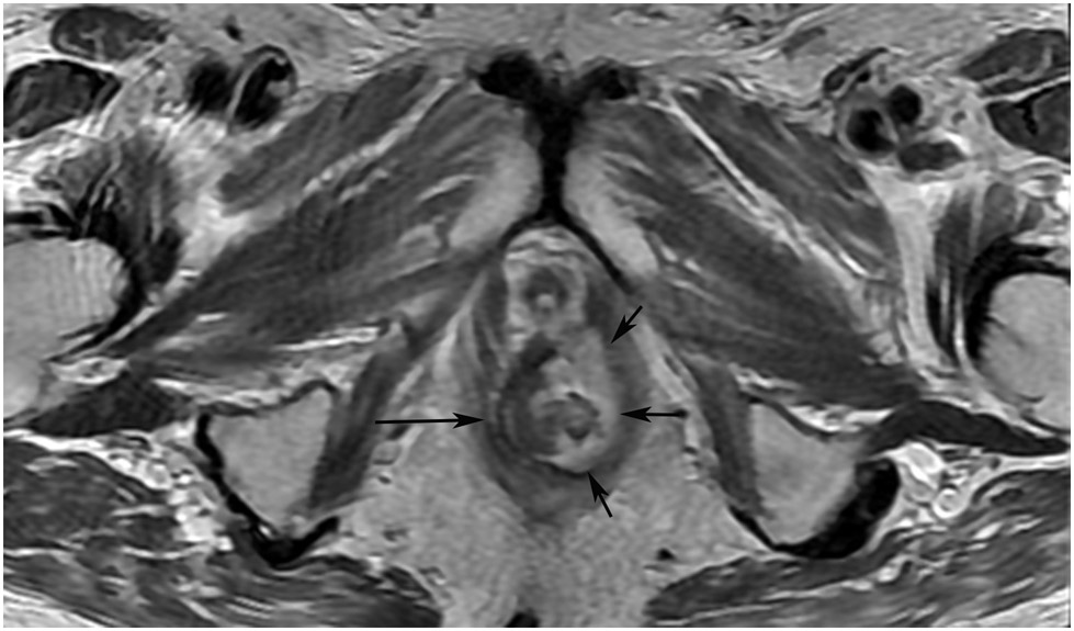 Figure 27: