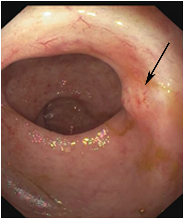 Figure 20: