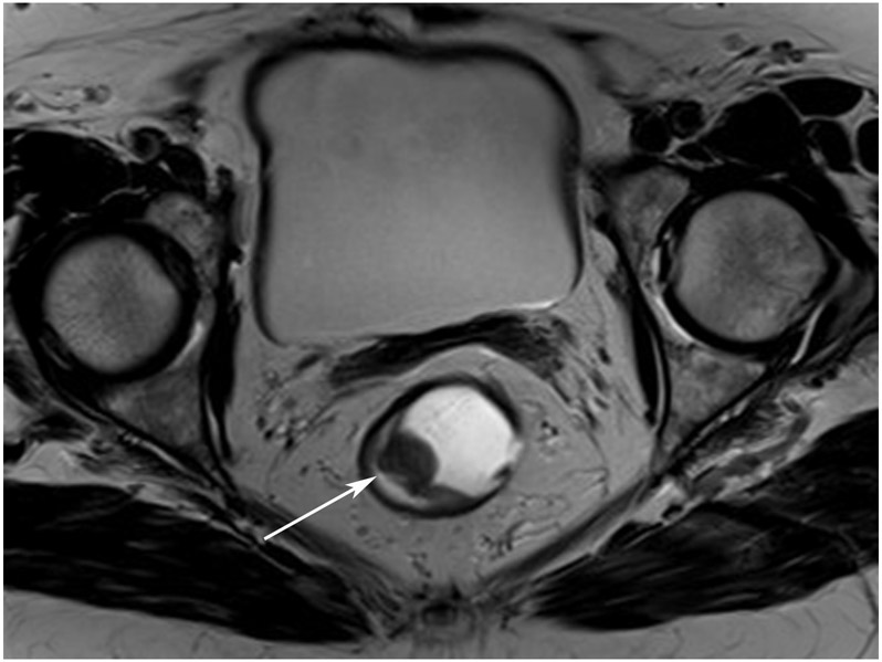 Figure 14: