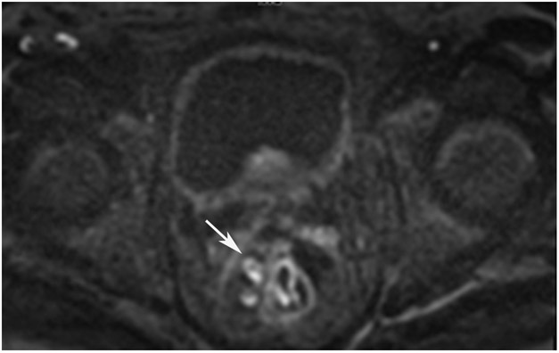 Figure 25: