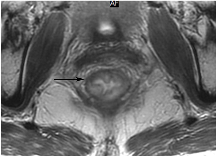 Figure 15: