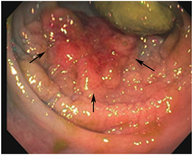 FIGURE 13: