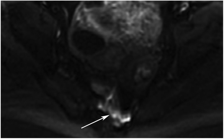 FIGURE 13: