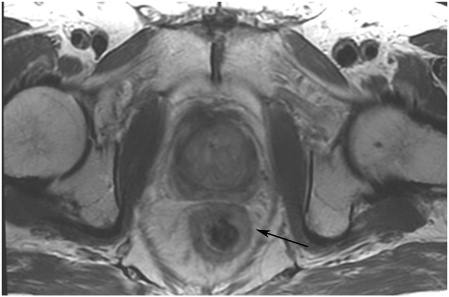 FIGURE 12: