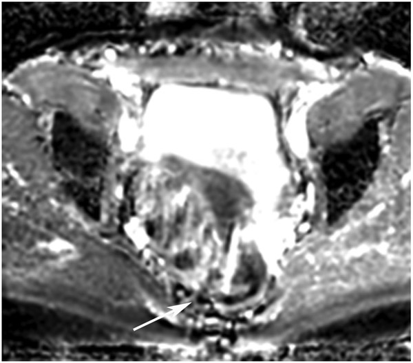 Figure 26: