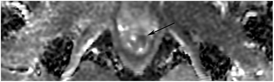 Figure 18: