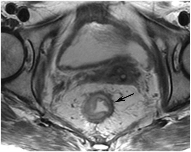 Figure 20: