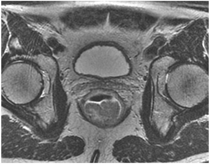 Figure 22: