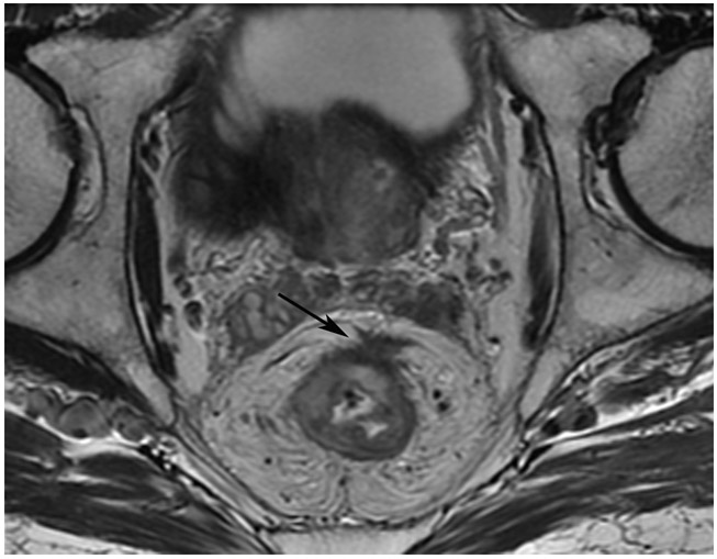 Figure 25: