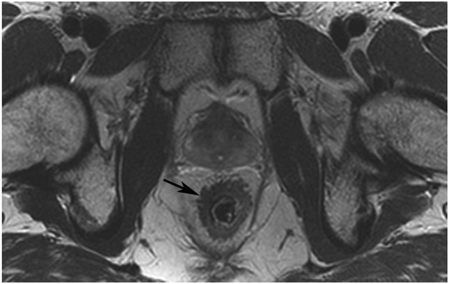 Figure 21: