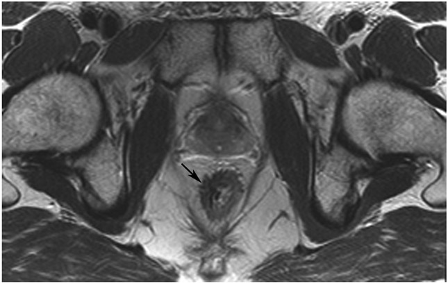 Figure 21: