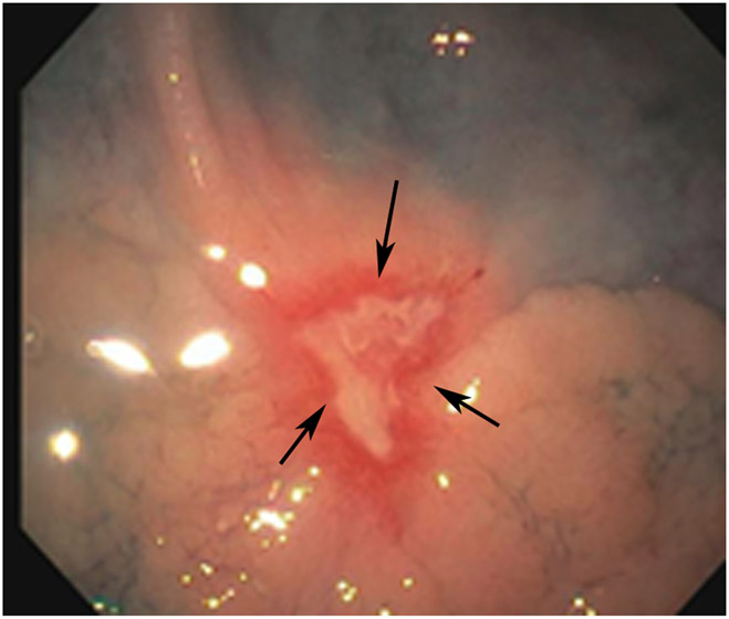 FIGURE 13: