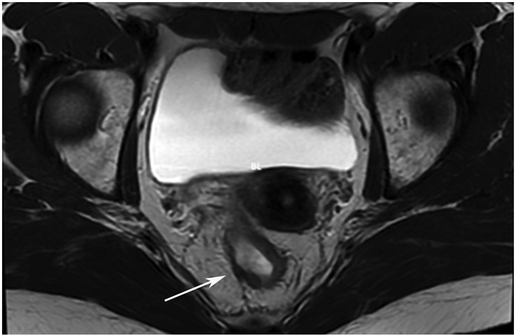 Figure 26: