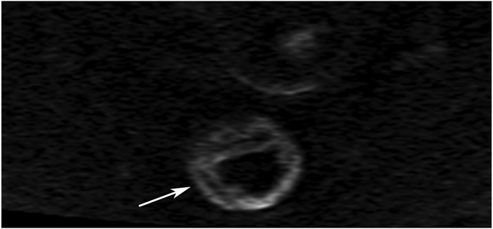 FIGURE 13: