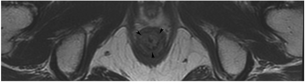 Figure 18: