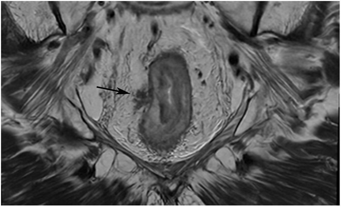 Figure 25: