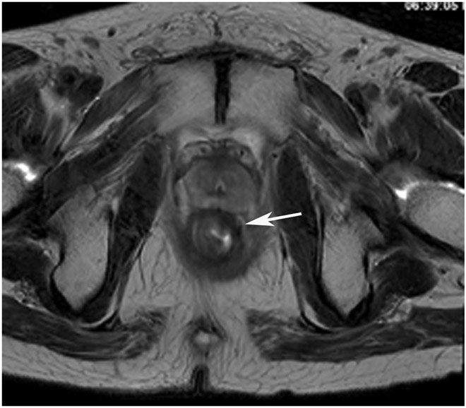 Figure 24: