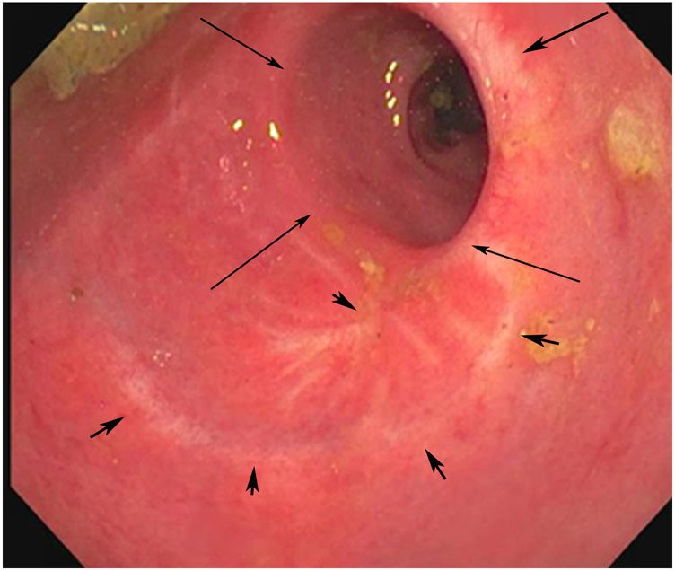 Figure 14: