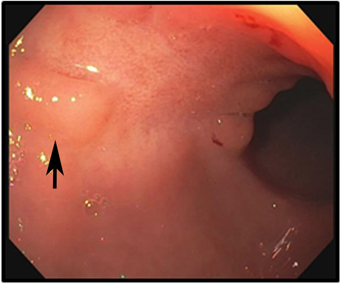 FIGURE 3: