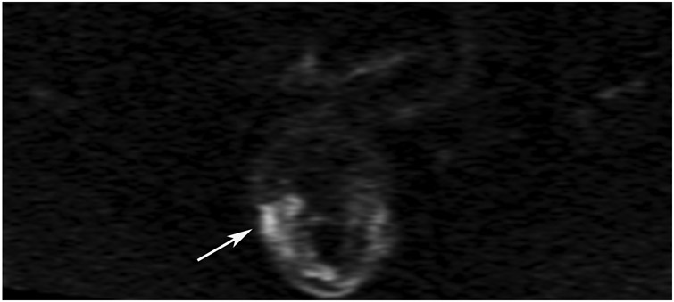 FIGURE 13: