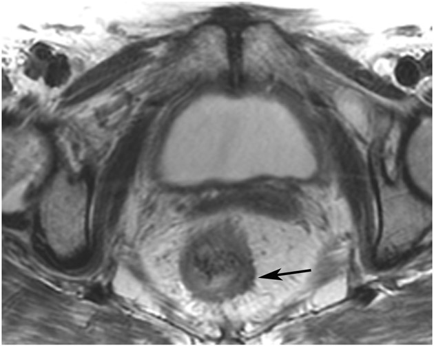 Figure 20: